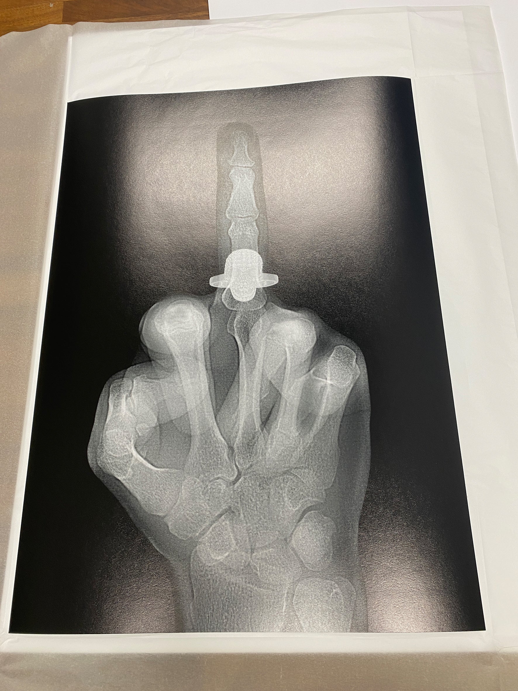 X-ray Mid Finger black and white - print