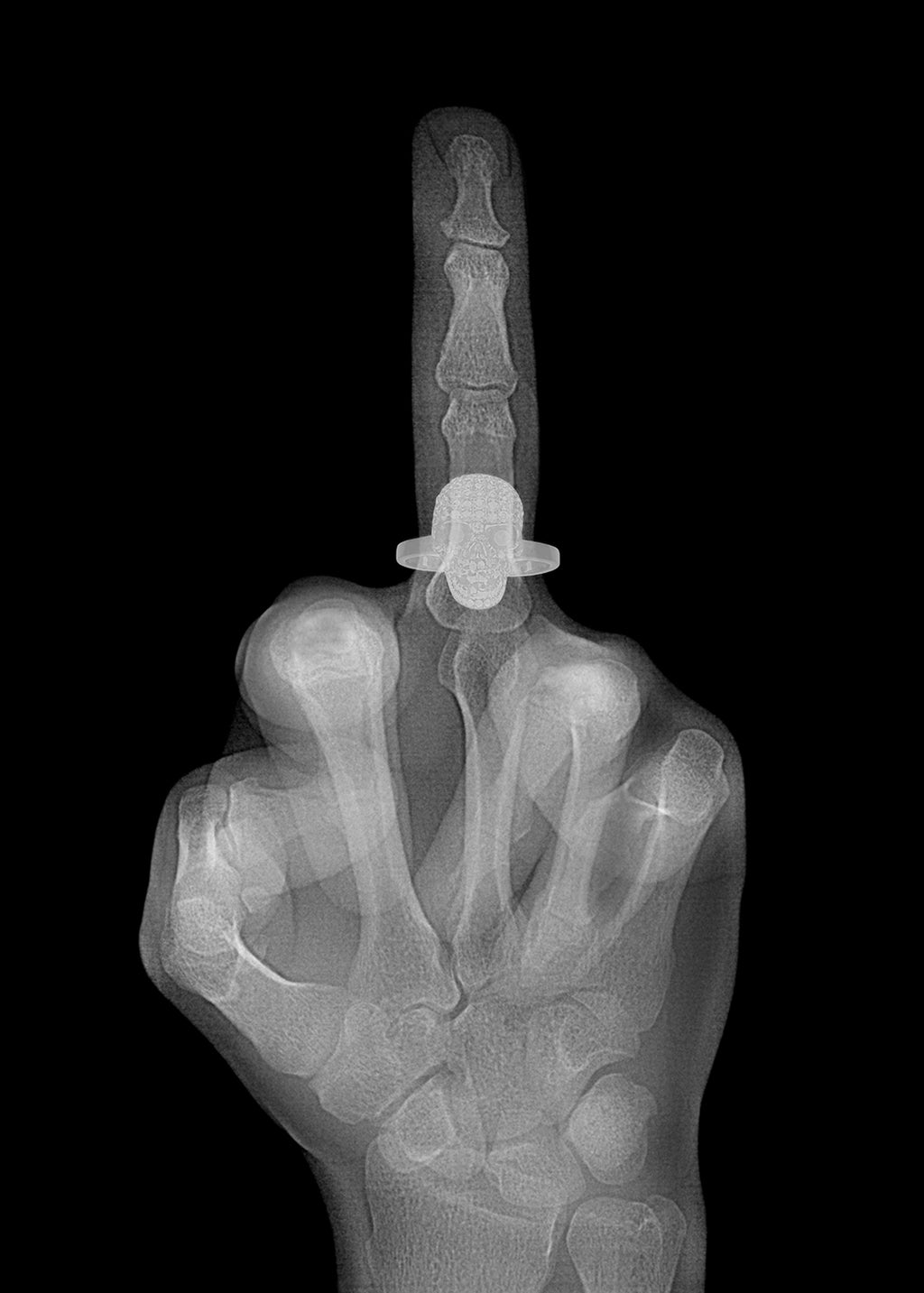 X-ray Mid Finger black and white- skull